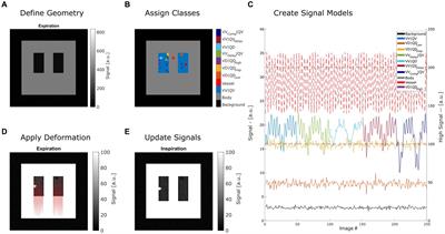 A synthetic lung model (ASYLUM) for validation of functional lung imaging methods shows significant differences between signal-based and deformation-field-based ventilation measurements